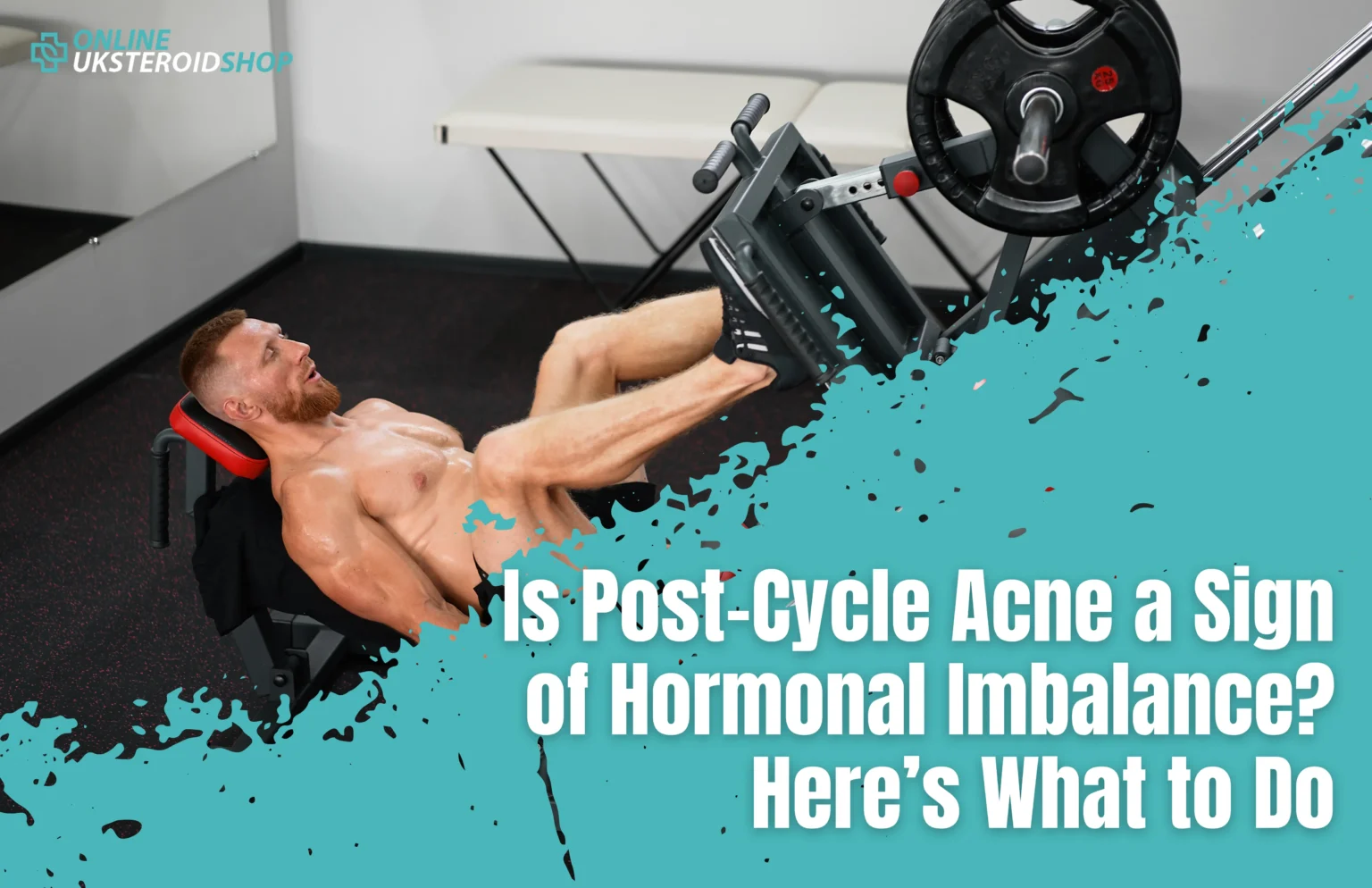 Is Post-Cycle Acne a Sign of Hormonal Imbalance? Here’s What to Do